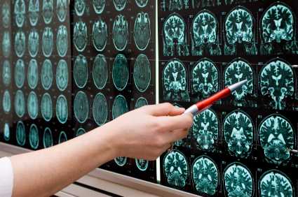 brain injury scan